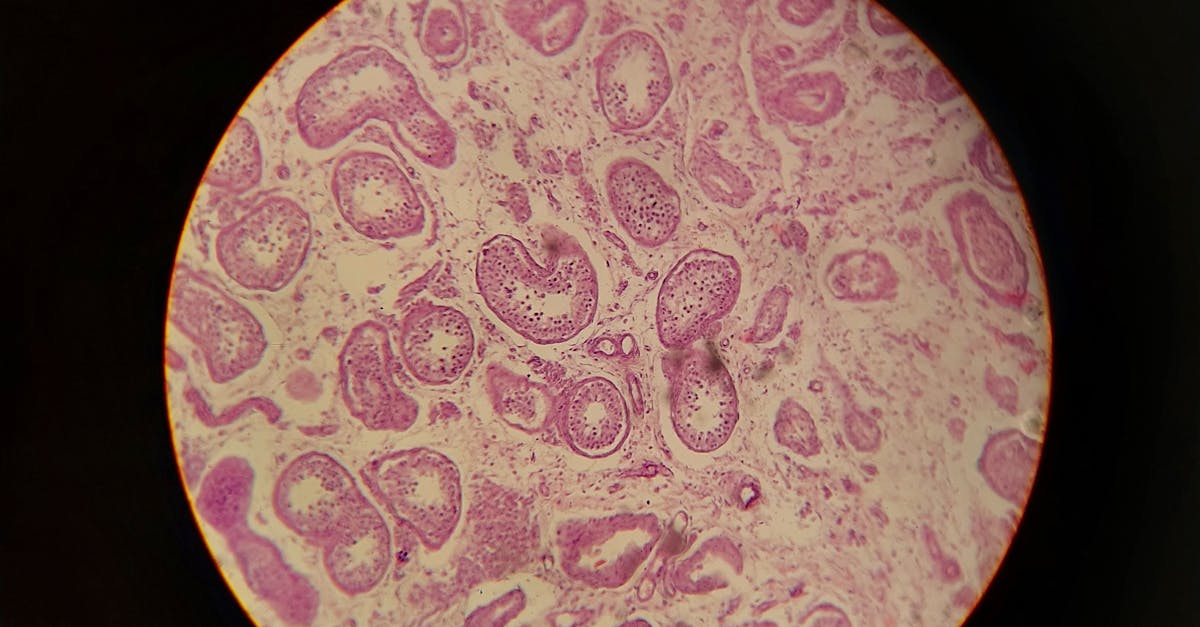 Scientist in a lab coat looking through a microscope, analyzing a tissue sample for breast cancer diagnosis.